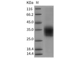 Recombinant Rat CLEC4A2/DCIR Protein (His Tag)