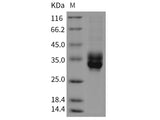Recombinant Rat CLEC4B2/mDCAR1 Protein (His Tag)