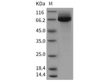 Recombinant Rat CD36/SCARB3 Protein (His Tag)