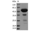 Recombinant Rat CLEC2D/OCIL Protein (Fc Tag)