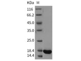Recombinant Rat REG3A/HIP Protein (His Tag)