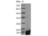 Recombinant Rat Galectin-1/LGALS1 Protein