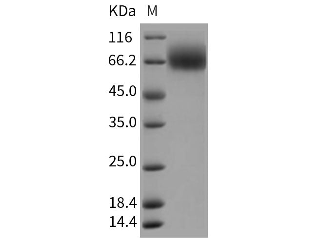 Recombinant Rat TrkB/NTRK2 Protein (His Tag)(Active)