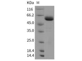 Recombinant Rat JAM-A/F11R Protein (Fc Tag)