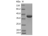 Recombinant Rat MDH1 Protein (His Tag)