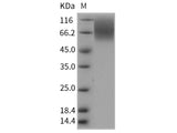 Recombinant Rat CEACAM1/CD66a Protein (His Tag) Stored at -20 to -80℃