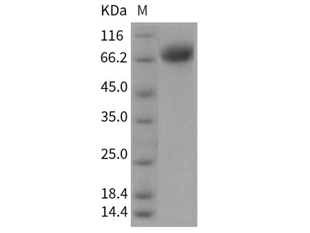 Recombinant Rat BCAM Protein (His Tag)(Active)