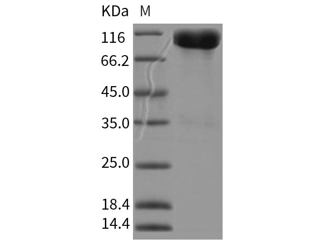 Recombinant Rat ALCAM/CD166 Protein (Fc Tag)(Active)