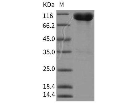 Recombinant Rat ALCAM/CD166 Protein (Fc Tag)(Active)