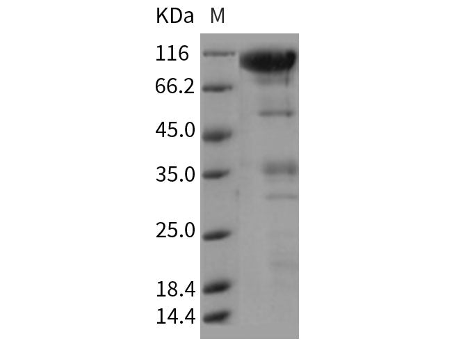 Recombinant Rat CLEC14A/EGFR-5 Protein (Fc Tag)