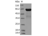Recombinant Rat CD23 Protein (Fc Tag)