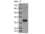 Recombinant Rat XEDAR/EDA2R Protein (His Tag)