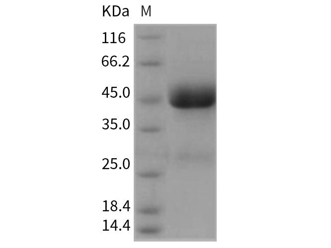 Recombinant Rat IL13RA2/CD213A2 Protein (His Tag)(Active)