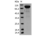 Recombinant Rat IL13RA2/CD213A2 Protein (Fc Tag)(Active)