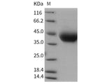 Recombinant Rat IL4RA/CD124 Protein (His Tag)(Active)