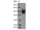 Recombinant Rat IL2RG/CD132 Protein (His Tag)