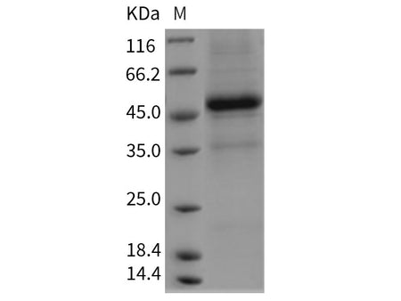 Recombinant Rat Interleukin-25/IL-25 Protein (Fc Tag)(Active)