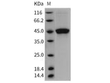 Recombinant Rat GITR/TNFRSF18 Protein (Fc Tag)