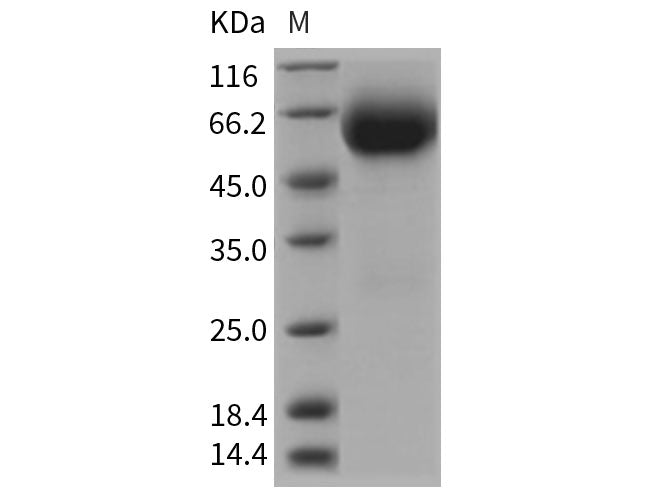 Recombinant Rat IL18R1 Protein (His Tag)
