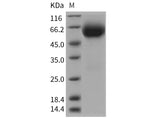 Recombinant Rat IL18R1 Protein (His Tag)
