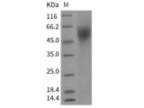 Recombinant Rat IL17RA Protein (His Tag)(Active)