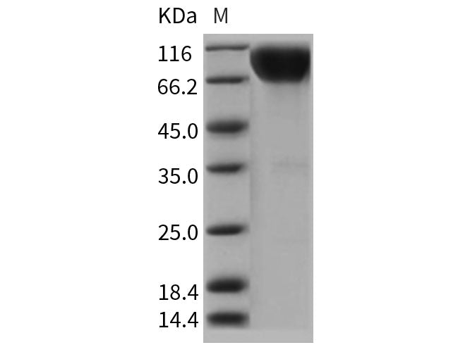 Recombinant Rat IL17RA Protein (Fc Tag)(Active)