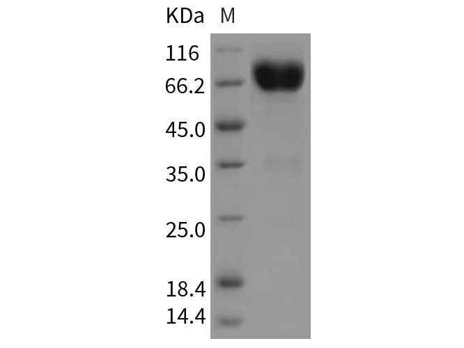 Recombinant Rat IL10RB/IL10R2 Protein (Fc Tag)