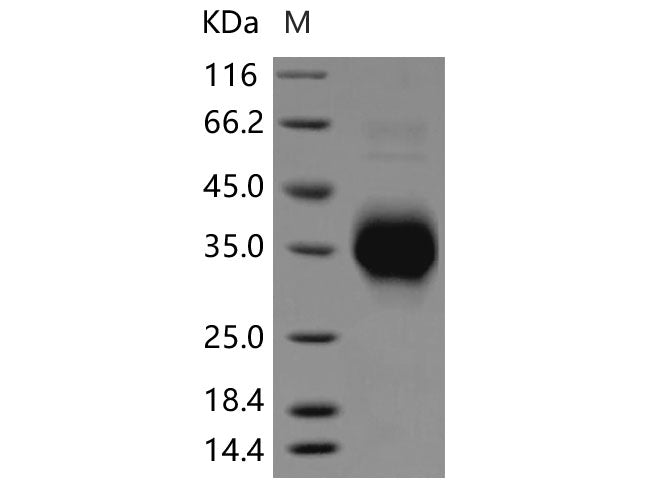 Recombinant Rat TNFR1/TNFRSF1A Protein (His Tag)(Active)