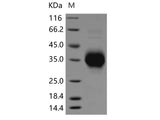 Recombinant Rat TNFR1/TNFRSF1A Protein (His Tag)(Active)