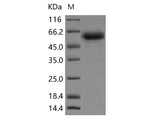 Recombinant Rat TNFR1/TNFRSF1A Protein (Fc Tag)(Active)