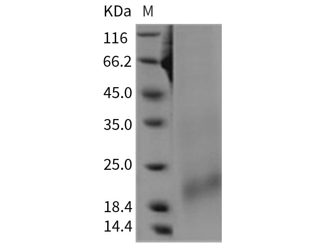Recombinant Rat BAFFR/TNFRSF13C Protein (His Tag)