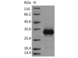 Recombinant Rat RANK/TNFRSF11A Protein (His Tag)