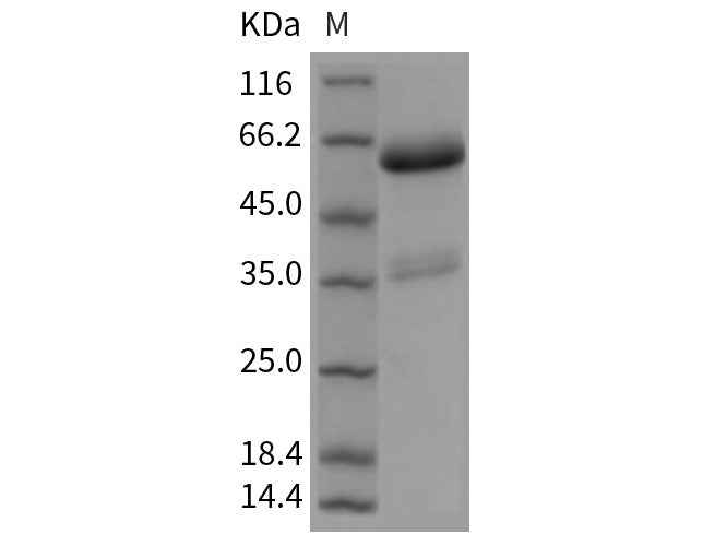 Recombinant Rat RANK/TNFRSF11A Protein (Fc Tag)
