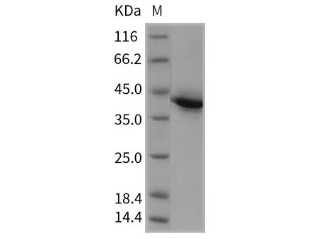 Recombinant Rat TNFRSF17/BCMA Protein (Fc Tag)