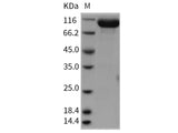 Recombinant Rat EphA4 Protein (Fc Tag)(Active)