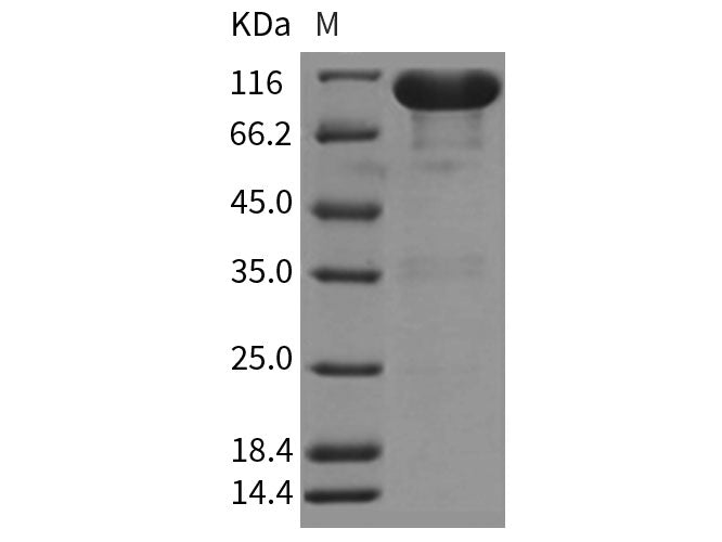 Recombinant Rat EphA7/EHK3 Protein (Fc Tag)(Active)