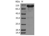 Recombinant Rat EphA7/EHK3 Protein (Fc Tag)(Active)