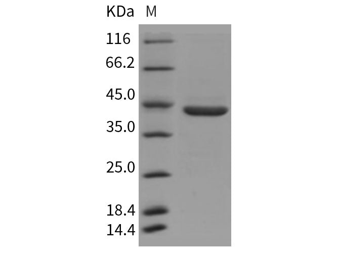Recombinant Rat Pepsinogen C/PGC Protein (His Tag)