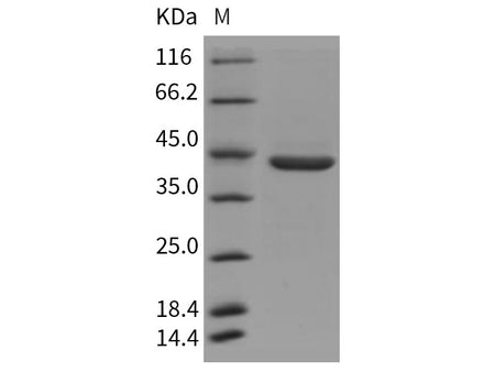 Recombinant Rat Pepsinogen C/PGC Protein (His Tag)