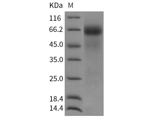 Recombinant Rat FGFR4/CD334 Protein (His Tag)