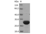 Recombinant Rat UCHL3/UCH-L3 Protein (His Tag)(Active)