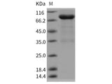 Recombinant Rat UNC5B/UNC5H2 Protein (Fc Tag)