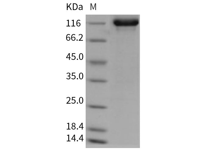 Recombinant Rat Tie2/TEK Protein (Fc Tag)(Active)