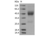 Recombinant Rat Neurexophilin-1/NXPH1 Protein (His Tag)
