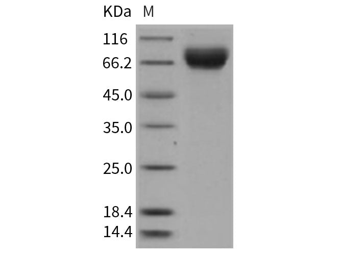 Recombinant Rat E-Selectin/SELE Protein (His Tag)(Active)