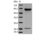 Recombinant Rat PCSK9 Protein (His Tag)(Active)