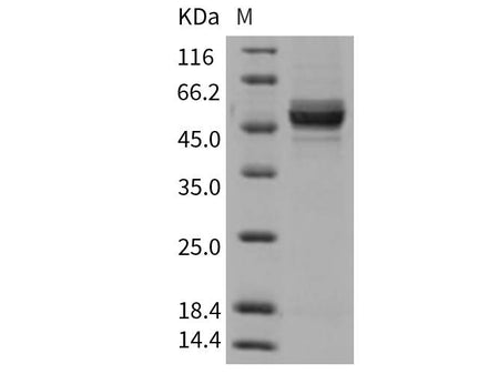 Recombinant Rat GPT2 Protein (His Tag)