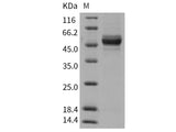 Recombinant Rat GPT2 Protein (His Tag)