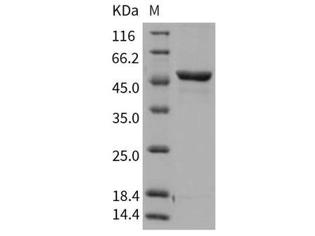 Recombinant Rat GPT1/GPT Protein (His Tag)
