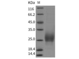 Recombinant Rat CTLA-4/CD152 Protein (ECD, His Tag)
